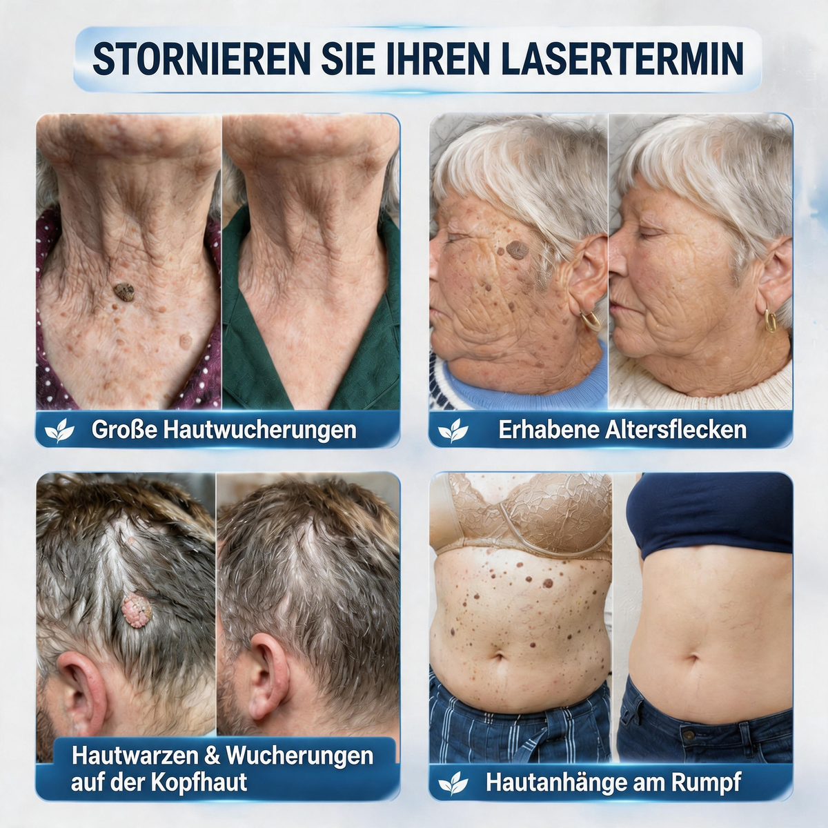 🔥 2. ARTIKEL 50 % RABATT! 🔥 Natravor® 7-Tage-Pflegecreme für Hautanhängsel & Hautflecken (𝐒𝐜𝐡𝐦𝐞𝐫𝐳𝐟𝐫𝐞𝐢𝐞 𝐅𝐨𝐫𝐦𝐞𝐥 – 𝐨𝐡𝐧𝐞 𝐍𝐚𝐫𝐛𝐞𝐧)